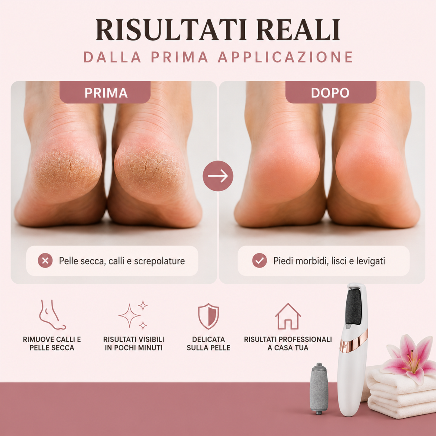 Nuréa SoftStep™ – Pedicure professionale a casa