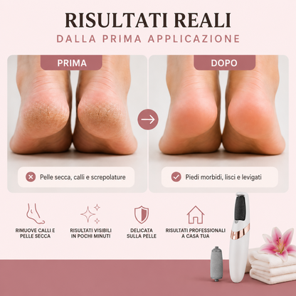 Nuréa SoftStep™ – Pedicure professionale a casa